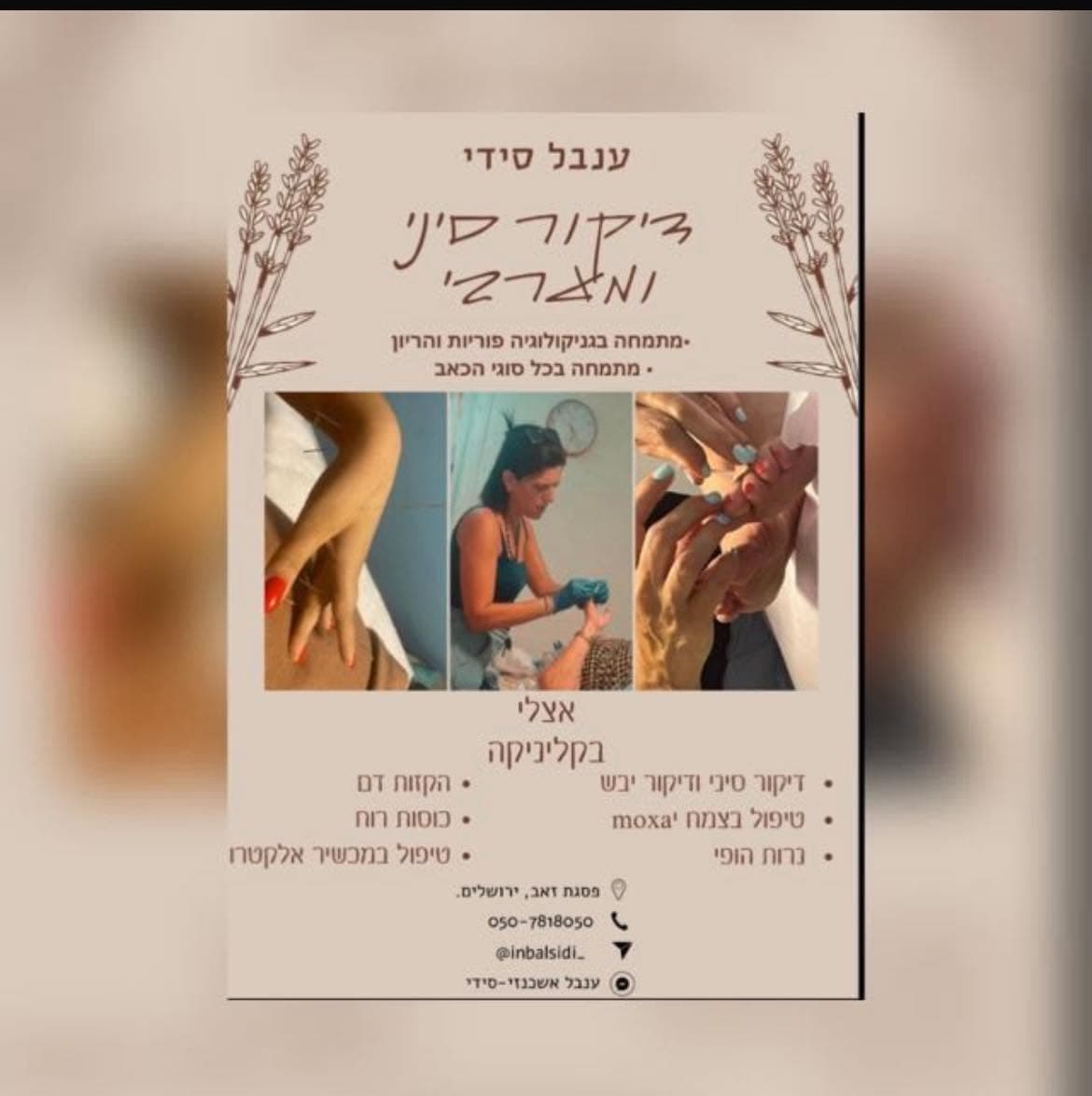 ענבל סידי דיקור סיני/יפני/מערבי image 1
